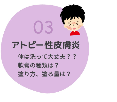 03アトピー性皮膚炎 体は洗って大丈夫？？軟膏の種類、量は？？